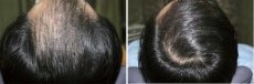 DERMAHEAL Hair Conditioning Shampoo 250 ml šampon pro obnovení růstu vlasů
