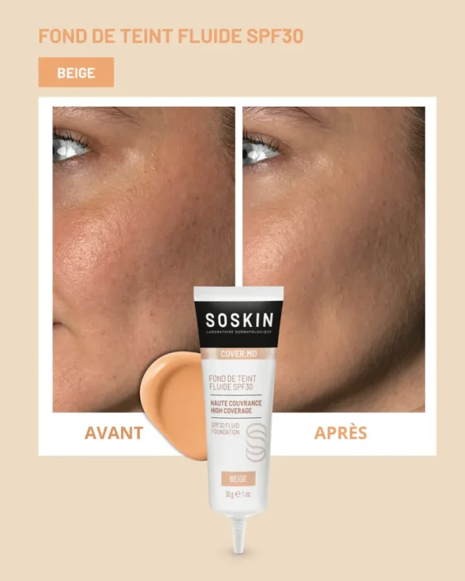 Fluidní make-up SOSKIN Fluid SPF30 | Beige 30g