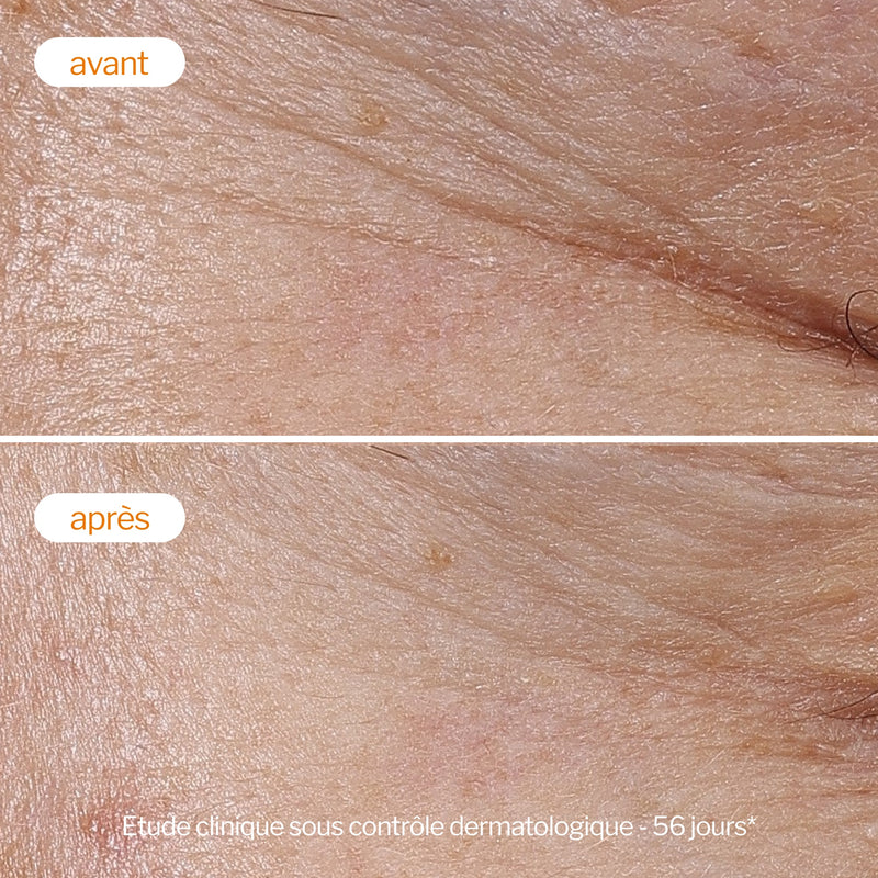 NOVEXPERT Light Vitamin C Cream 40 ml - rozjasňující krém