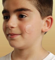 NewGel NG 180 - bodová béžová náplast 6 ks