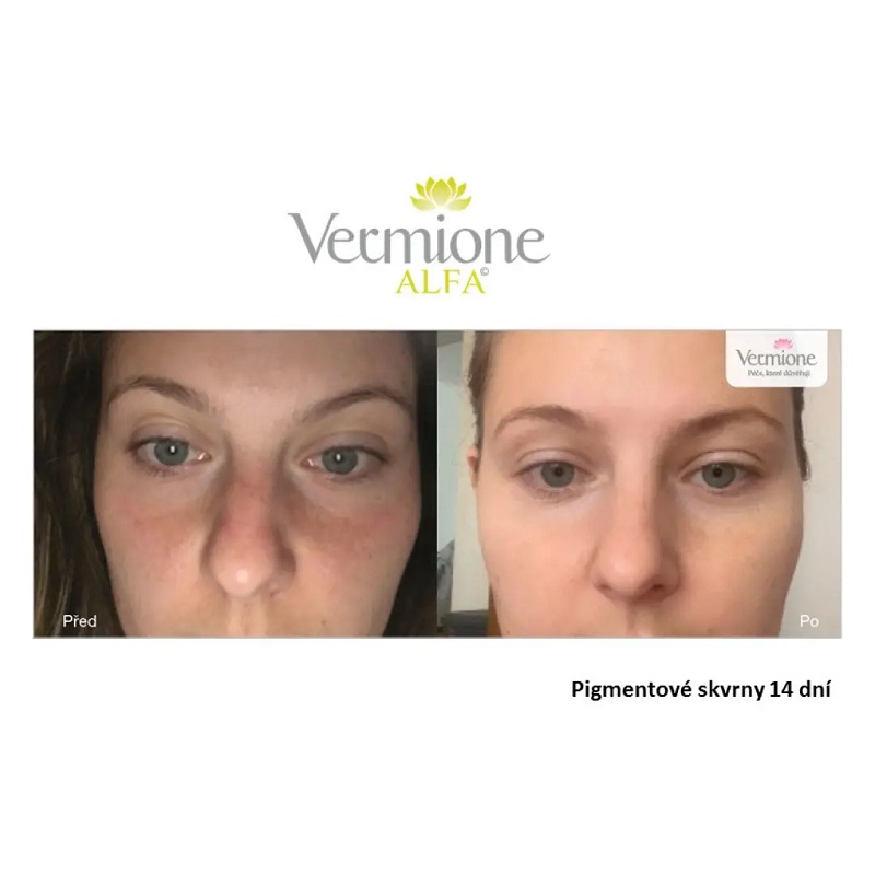 VERMIONE Alfa - hydratační a regenerační krém 50 ml