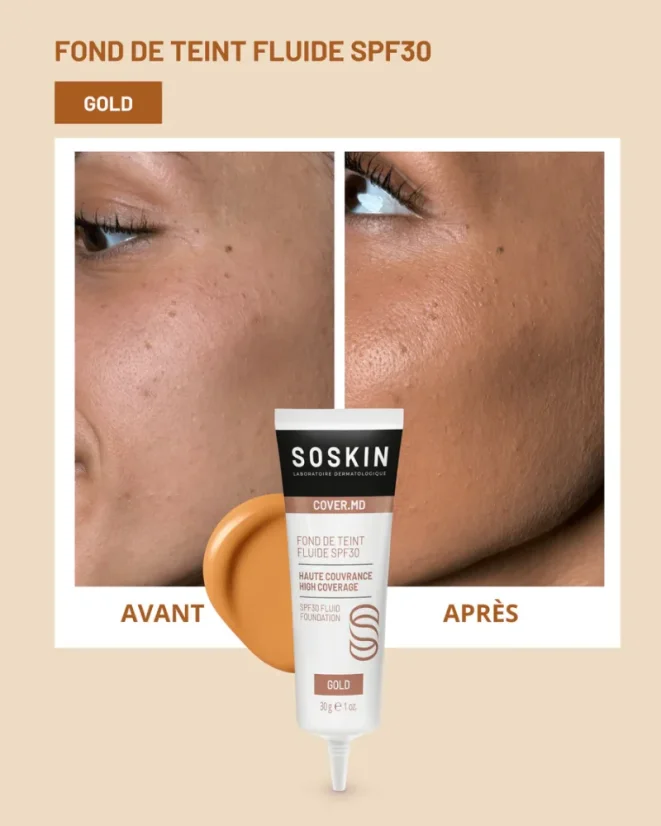 Fluidní make-up SOSKIN Fluid SPF30 | Gold 30g