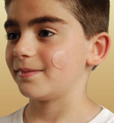 NewGel NG 180 - bodová béžová náplast 6 ks