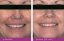 ELURE Advanced Facial Wash - Zesvětlující čisticí pěna 100 ml