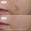 NOVEXPERT Trio-Zinc Serum - pro mastnou a aknózní pleť