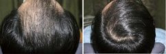 DERMAHEAL Hair Conditioning Shampoo 250 ml šampon pro obnovení růstu vlasů