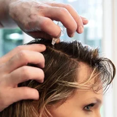ELGON Primaria Stimulating Anti-Hair - Kúra proti vypadávání vlasů 24 x 8 ml
