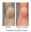 NEOSTRATA Problem Dry Skin - krém pro suchou pokožku 100 g