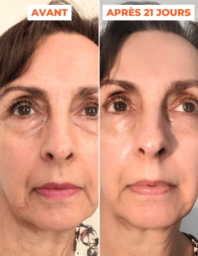 DERMEDEN Advanced Peel - domácí peeling 2 x 30 ml
