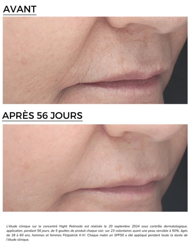 DERMEDEN Retinal Retinoids 6% - omlazující noční sérum 30 ml