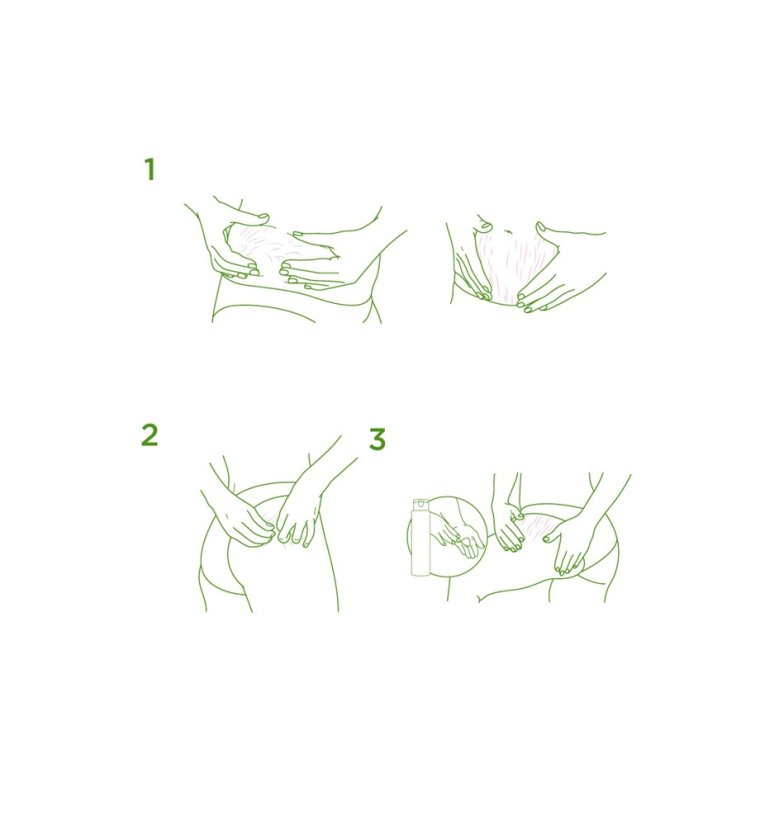 ELANCYL Strech Marks Correction Gelcream - krém na strie 75 ml