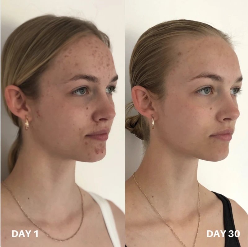 CLINISOOTHE Skin Purifier - zklidňující čistící tonikum 250 ml