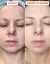 DERMEDEN Advanced Peel - domácí peeling 2 x 30 ml